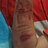 erick9308371